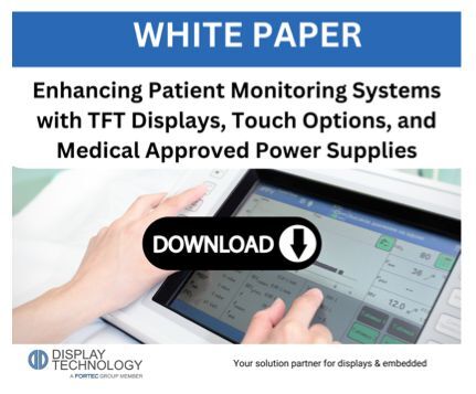 benefits of tft display supplier